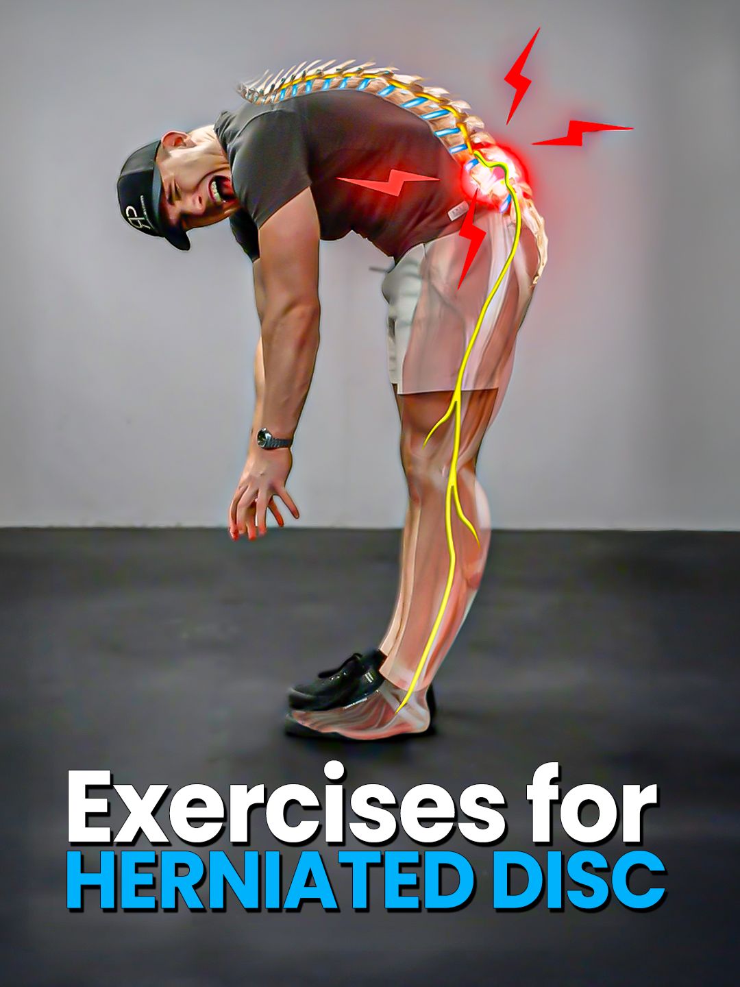 💥 Low Back Pain Rehab #backpain